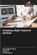 Imaging degli impianti dentali