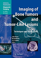 Imaging of Bone Tumors and Tumor-Like Lesions: Techniques and Applications
