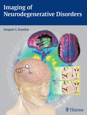 Imaging of Neurodegenerative Disorders - Kanekar, Sangam (Editor)