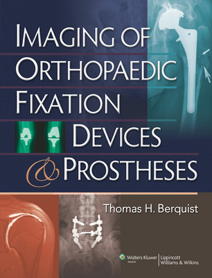 Imaging of Orthopaedic Fixation Devices and Prostheses - Berquist, Thomas H, MD, Facr