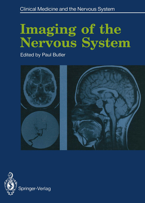 Imaging of the Nervous System - Butler, Paul (Editor)