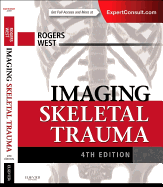 Imaging Skeletal Trauma