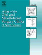 Implant Procedures, an Issue of Atlas of the Oral and Maxillofacial Surgery Clinics: Volume 14-1