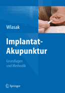 Implantat-Akupunktur: Grundlagen Und Methodik