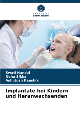 Implantate bei Kindern und Heranwachsenden - Nandal, Swati, and Sikka, Neha, and Kaushik, Ashutosh