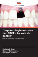 "Implantologie assist?e par CBCT: La voie du succ?s"