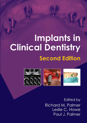 Implants in Clinical Dentistry - Palmer, Richard M, and Howe, Leslie C, and Palmer, Paul J