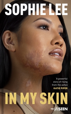 In My Skin: Learning to Love Your Perfectly Imperfect Life - Lee, Sophie