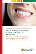 Influ?ncia dos adesivos na colagem de Brackets Cer?micos