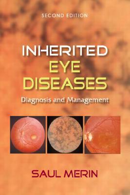 Inherited Eye Diseases: Diagnosis and Management - Merin, Saul