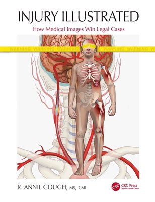 Injury Illustrated: How Medical Images Win Legal Cases - Gough, R. Annie