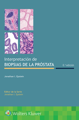 Interpretaci?n de Biopsias de la Pr?stata - Epstein, Jonathan I, MD