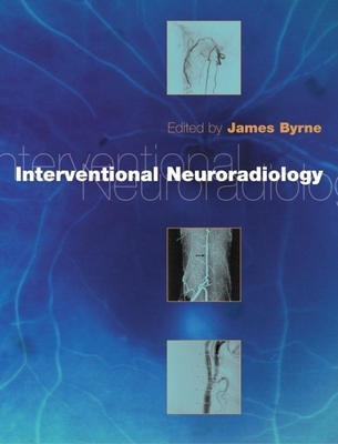 Interventional Neuroradiology: Theory and Practice - Byrne, James Vincent (Editor)