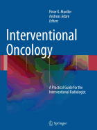 Interventional Oncology: A Practical Guide for the Interventional Radiologist - Mueller, Peter (Editor), and Adam, Andreas (Editor)