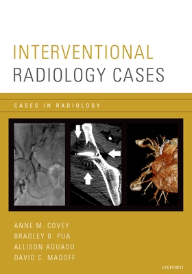 Interventional Radiology Cases - Covey, Anne M (Editor), and Pua, Bradley (Editor), and Aguado, Allison (Editor)