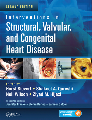 Interventions in Structural, Valvular and Congenital Heart Disease - Sievert, Horst (Editor), and Qureshi, Shakeel A. (Editor), and Wilson, Neil (Editor)
