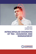 Intracapsular Disorders of Tmj: Diagnosis and Management