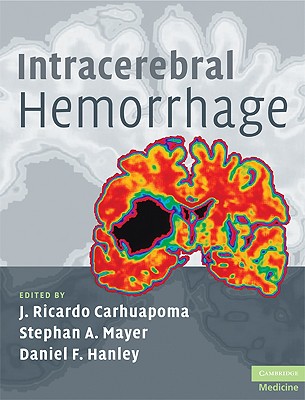 Intracerebral Hemorrhage - Carhuapoma, J Ricardo (Editor), and Mayer, Stephan A, MD (Editor), and Hanley, Daniel F (Editor)