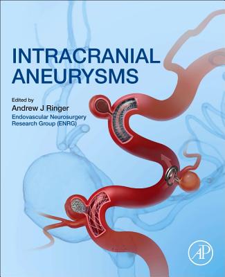 Intracranial Aneurysms - Ringer, Andrew J. (Editor)