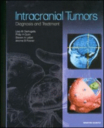 Intracranial Tumors: Diagnosis and Treatment