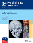 Invasive Skull Base Mucormycosis: New Perspectives