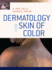 Dermatology for Skin of Color (Hb 2009)