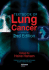 Txbk of Lung Cancer, 2