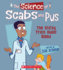 The Science of Scabs and Pus: the Sticky Truth About Blood (Science of the Body)