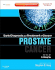 Early Diagnosis and Treatment of Cancer Series: Prostate Cancer: Expert Consult-Online and Print (Early Diagnosis in Cancer)