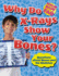 Why Do X-Rays Show Your Bones? : Questions About Bones and the Skeleton (Human Body Faq)