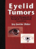 Eyelid Tumors: Clinical Diagnosis and Surgical Treatment