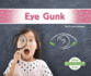 Eye Gunk 9781644943816