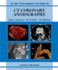 Ct Coronary Angiography: an Atlas of Investigation and Diagnosis