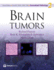 Brain Tumors (Consultant Pathology, Volume 2)