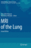 Mri of the Lung 2ed (Hb 2010)