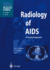 Radiology of Aids (Medical Radiology)