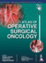 Atlas of Operative Surgical Oncology