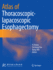 Atlas of Thoracoscopic-Lapacoscopic Esophagectomy