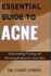 Essential Guide to Acne: Understanding, Treating, and Preventing Breakouts for Clearer Skin