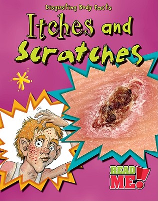 Itches and Scratches - Royston, Angela