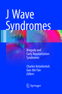 J Wave Syndromes: Brugada and Early Repolarization Syndromes