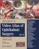 Jaypee's Video Atlas of Ophthalmic Surgery: Volume II