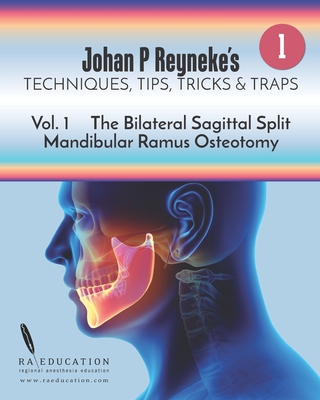 Johan P Reyneke's Techniques, Tips, Tricks and Traps: Volume 1: The Bilateral Sagittal Split Mandibular Ramus Osteotomy - Reyneke, Johan P