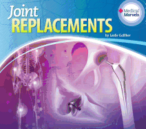 Joint Replacements