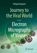 Journey to the Viral World: Electron Micrographs of Viruses