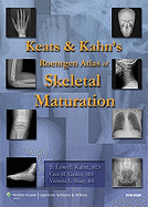 Keats and Kahn's Roentgen Atlas of Skeletal Maturation - S Lowell Kahn, Cree M Gaskin, Victoria L Sharp