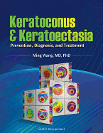Keratoconus & Keratoectasia: Prevention, Diagnosis, and Treatment