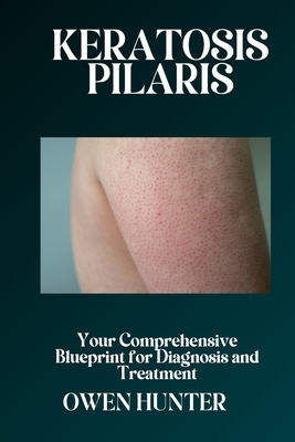 Keratosis Pilaris: Your Comprehensive Blueprint for Diagnosis and Treatment - Hunter, Owen