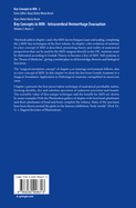 Key Concepts in MIN - Intracerebral Hemorrhage Evacuation: Volume 2: Basics 2