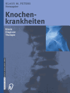 Knochenkrankheiten: Klinik Diagnose Therapie - Peters, Klaus M (Editor), and Eysel, P (Foreword by)